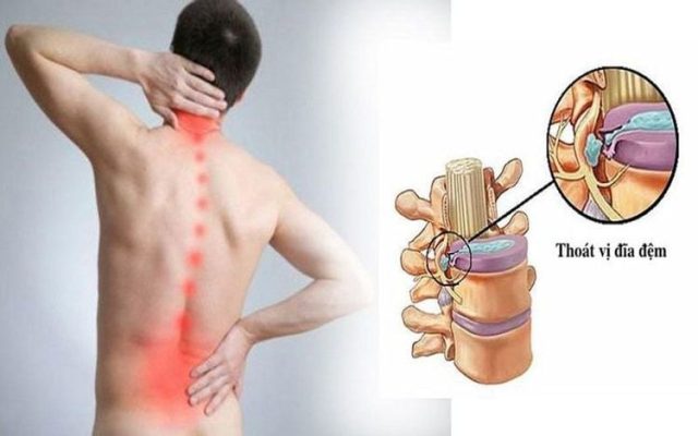 Triệu chứng thường gặp